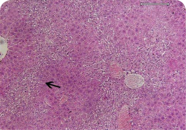 The first report of pyrrolizidine alkaloid poisoning in a gazelle (<i>Gazella Subgutturosa</i>) - histopathologic diagnosis.