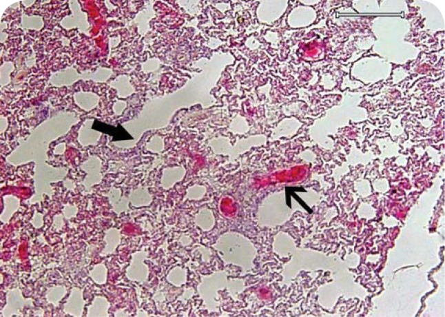 The first report of pyrrolizidine alkaloid poisoning in a gazelle (<i>Gazella Subgutturosa</i>) - histopathologic diagnosis.