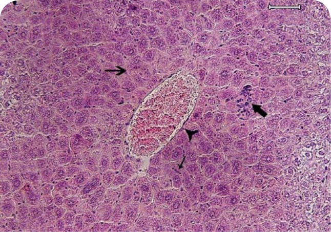 The first report of pyrrolizidine alkaloid poisoning in a gazelle (<i>Gazella Subgutturosa</i>) - histopathologic diagnosis.