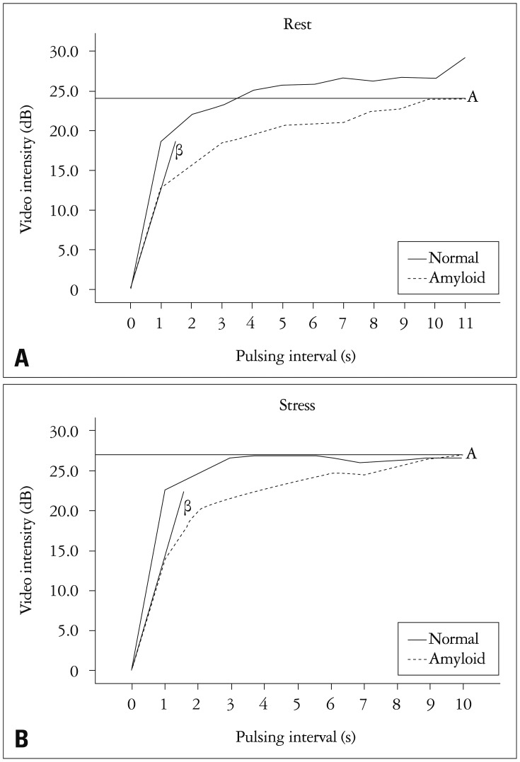 Abnormal Myocardial Blood Flow Reserve Observed in Cardiac Amyloidosis.