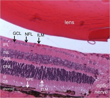 A glimpse at the aging eye