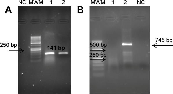 Assessment of Cytokeratin-19 Gene Expression in Peripheral Blood of Breast Cancer Patients and Breast Cancer Cell Lines.