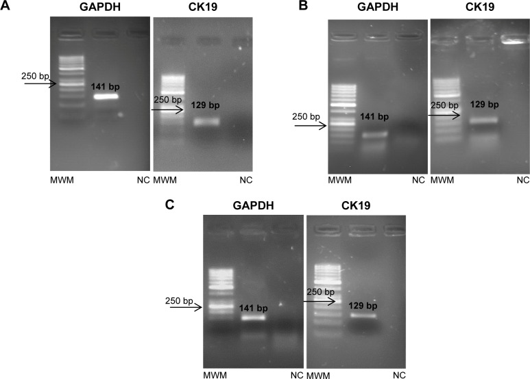 Assessment of Cytokeratin-19 Gene Expression in Peripheral Blood of Breast Cancer Patients and Breast Cancer Cell Lines.