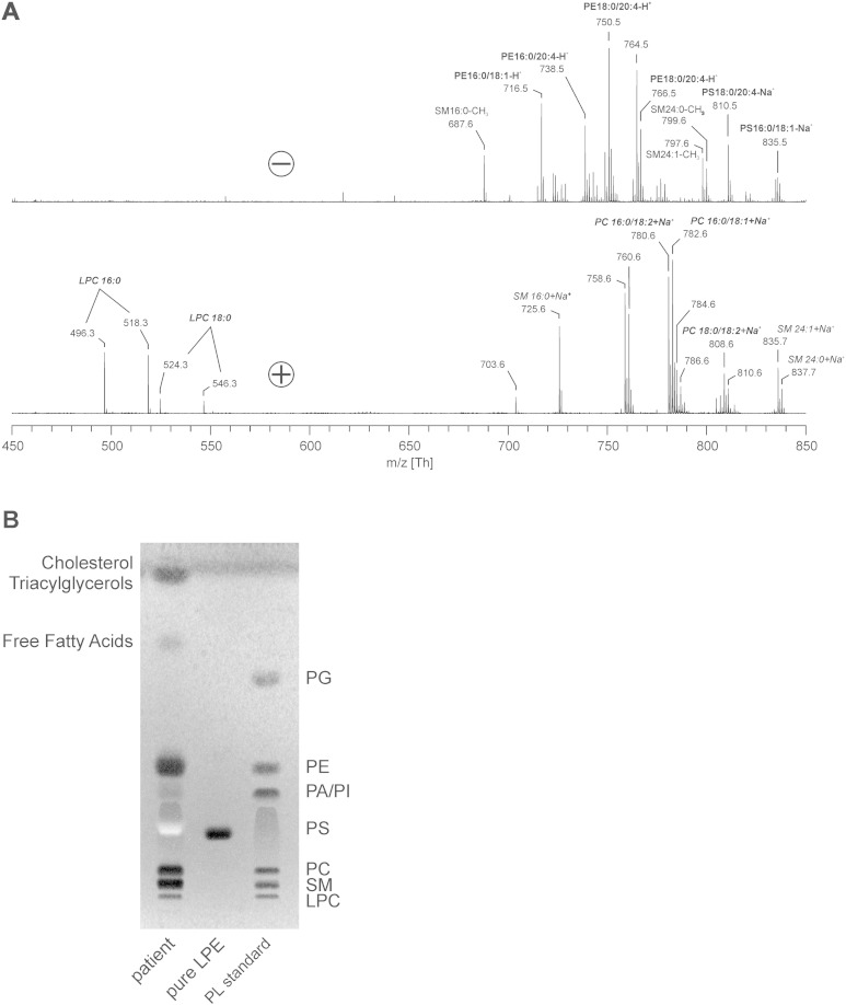 Inflammation-associated changes in lipid composition and the organization of the erythrocyte membrane