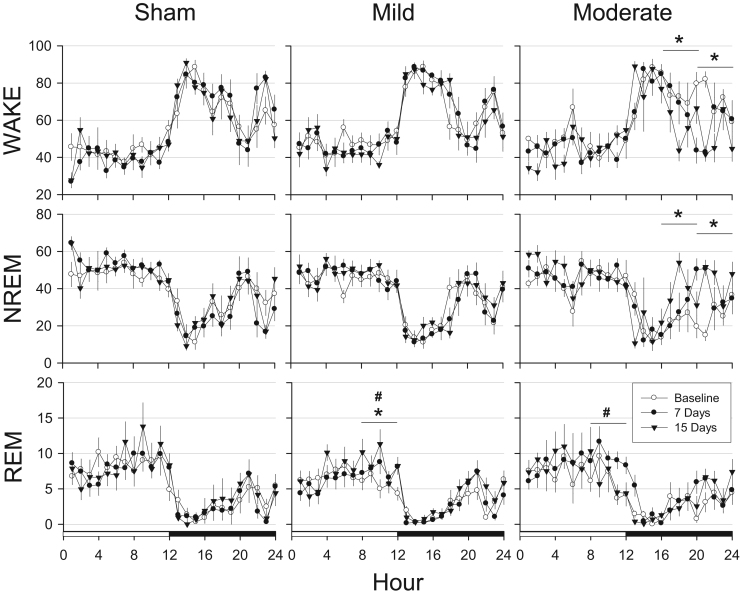 Hypocretinergic and cholinergic contributions to sleep-wake disturbances in a mouse model of traumatic brain injury