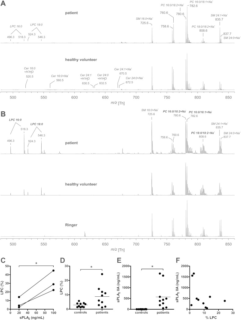 Inflammation-associated changes in lipid composition and the organization of the erythrocyte membrane