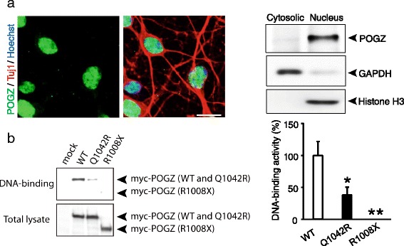 De novo POGZ mutations in sporadic autism disrupt the DNA-binding activity of POGZ.