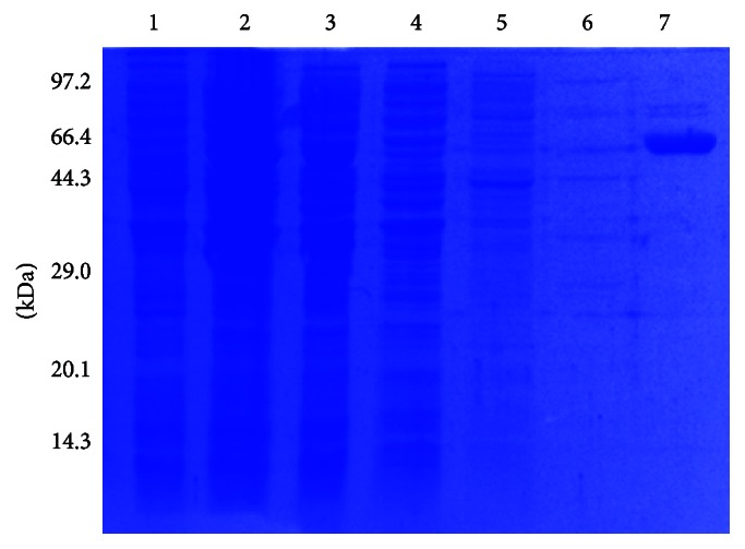 Characterization of the ATP-Dependent Lon-Like Protease in Methanobrevibacter smithii.