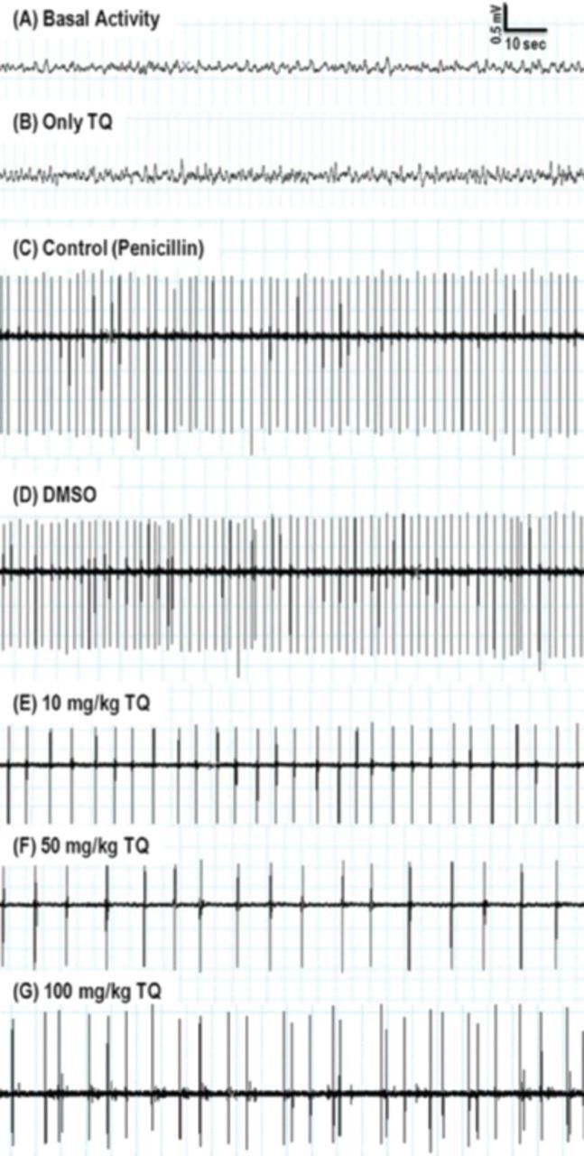 Effects of thymoquinone, the major constituent of Nigella sativa seeds, on penicillin-induced epileptiform activity in rats.