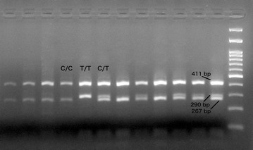 Polymorphism of the melatonin receptor 1A (MNTR1A) gene and association with seasonality of reproductive activity in a local Greek sheep breed.