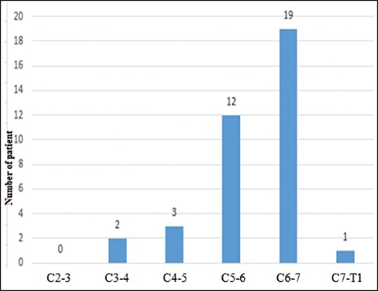 Cervical disc hernia operations through posterior laminoforaminotomy.