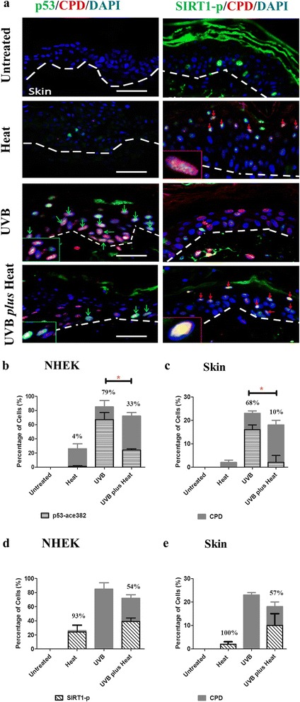 Heat-mediated reduction of apoptosis in UVB-damaged keratinocytes in vitro and in human skin ex vivo.