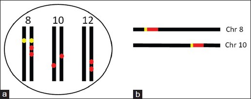 The well-accepted notion that gene amplification contributes to increased expression still remains, after all these years, a reasonable but unproven assumption.