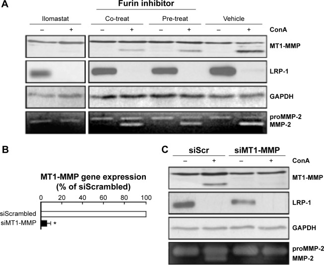 Impact of Concanavalin-A-Mediated Cytoskeleton Disruption on Low-Density Lipoprotein Receptor-Related Protein-1 Internalization and Cell Surface Expression in Glioblastomas.