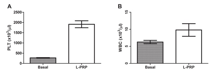 In vitro study of the role of thrombin in platelet rich plasma (PRP) preparation: utility for gel formation and impact in growth factors release.