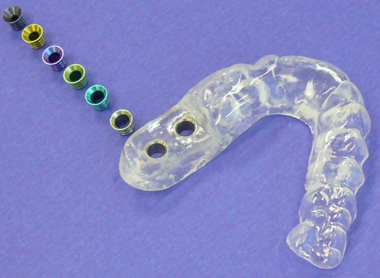 Accuracy of computer-assisted implant placement with insertion templates.