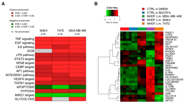 Stromal Activation by Tumor Cells: An in Vitro Study in Breast Cancer.