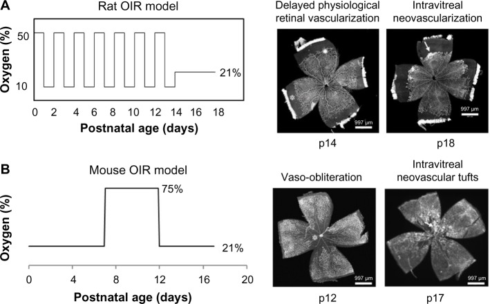 Anti-VEGF therapy in the management of retinopathy of prematurity: what we learn from representative animal models of oxygen-induced retinopathy.