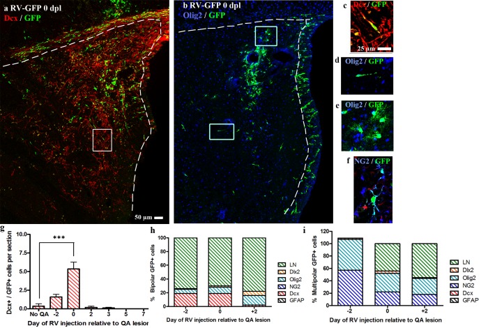 The Effect of Pro-Neurogenic Gene Expression on Adult Subventricular Zone Precursor Cell Recruitment and Fate Determination After Excitotoxic Brain Injury.