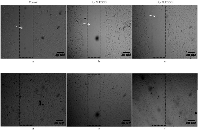 Epigallocatechin Gallate Inhibits Mouse Mesenchymal Stem Cell Differentiation to Adipogenic Lineage.