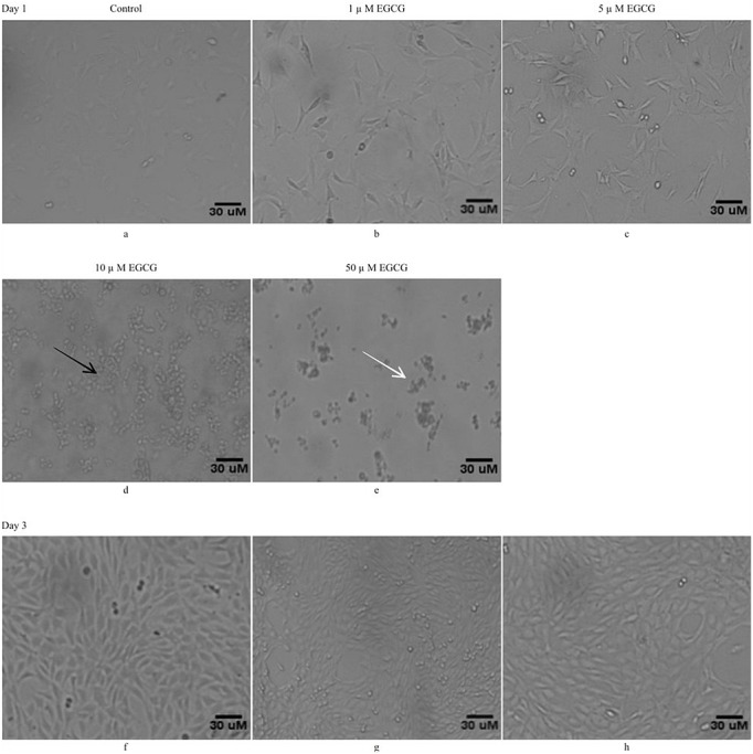 Epigallocatechin Gallate Inhibits Mouse Mesenchymal Stem Cell Differentiation to Adipogenic Lineage.