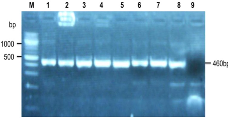 Molecular Identification of Nontuberculous Mycobacteria in Humans in Zimbabwe Using 16S Ribosequencing.