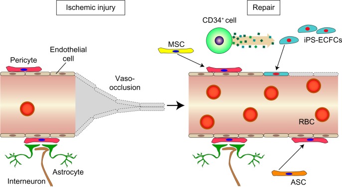 Promoting vascular repair in the retina: can stem/progenitor cells help?