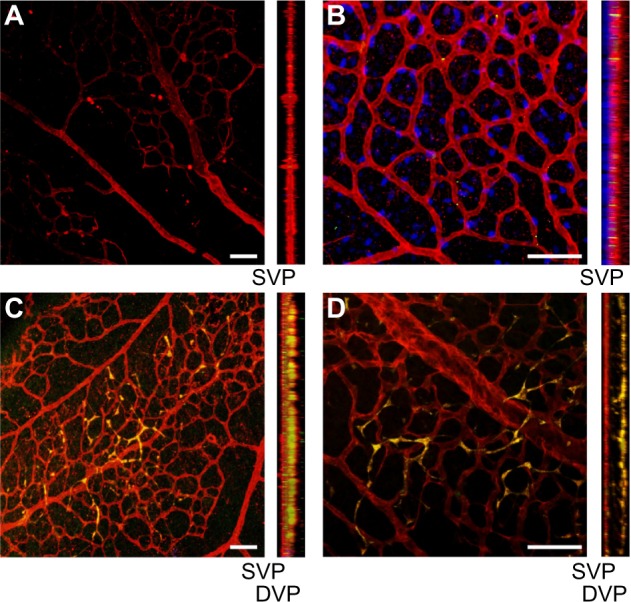 Promoting vascular repair in the retina: can stem/progenitor cells help?