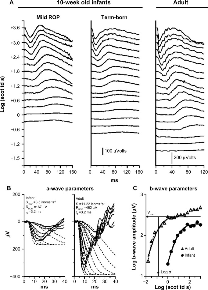 Retinal, visual, and refractive development in retinopathy of prematurity.