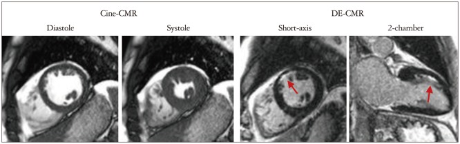 The Use of Cardiac Magnetic Resonance in Patients with Suspected Coronary Artery Disease: A Clinical Practice Perspective.