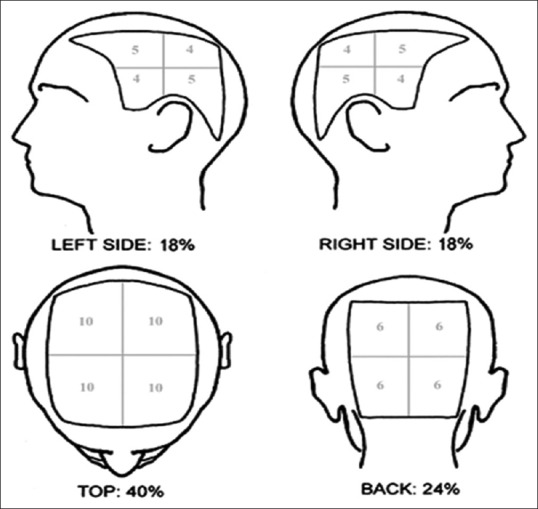 Comparative Study of Efficacy and Safety of Topical Squaric Acid Dibutylester and Diphenylcyclopropenone for the Treatment of Alopecia Areata.