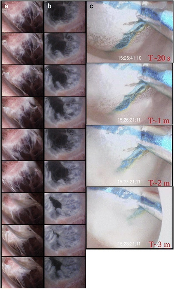 The novel in vitro reanimation of isolated human and large mammalian heart-lung blocs.