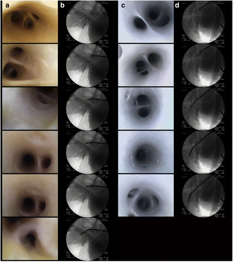 The novel in vitro reanimation of isolated human and large mammalian heart-lung blocs.