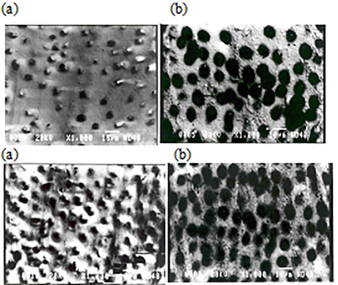 The Effect of Four Commonly Used Root Conditioner Agents in Different Time Periods Applied on Periodontally Diseased and Healthy Teeth.