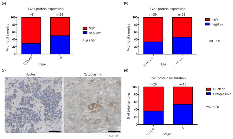 EYA1 expression and subcellular localization in neuroblastoma and its association with prognostic markers.