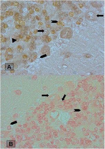 Staining of cerebellar cortex granular layer interneurons with natural dye of Madder.