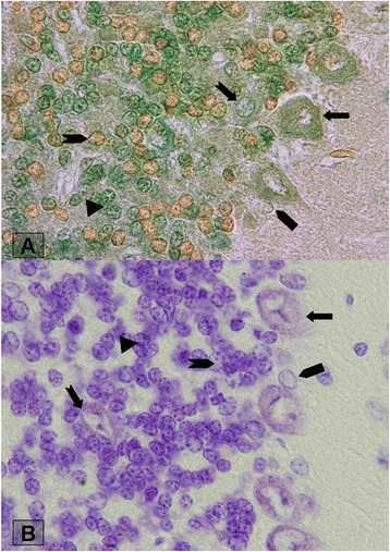 Staining of cerebellar cortex granular layer interneurons with natural dye of Madder.