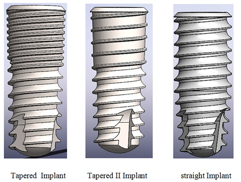 Assessing the Effect of Dental Implants Thread Design on Distribution of Stress in Impact Loadings Using Three Dimensional Finite Element Method.