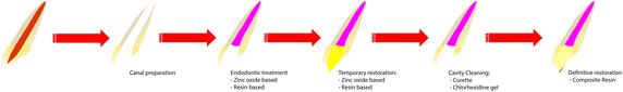 Influence of eugenol-based materials and cleaning procedures previously to resin composite restoration on microleakage after 1-year storage