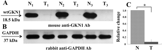 Gastrokine 1 mRNA in human sera is not informative biomarker for gastric cancer.