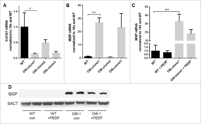 Pigment epithelium-derived factor (PEDF) normalizes matrix defects in iPSCs derived from Osteogenesis imperfecta Type VI.