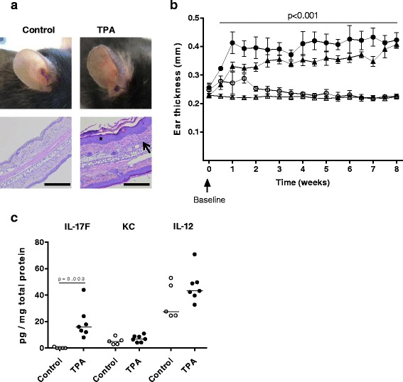 Effect of 12-O-tetradecanoylphorbol-13-acetate-induced psoriasis-like skin lesions on systemic inflammation and atherosclerosis in hypercholesterolaemic apolipoprotein E deficient mice.