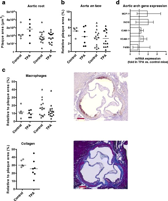 Effect of 12-O-tetradecanoylphorbol-13-acetate-induced psoriasis-like skin lesions on systemic inflammation and atherosclerosis in hypercholesterolaemic apolipoprotein E deficient mice.