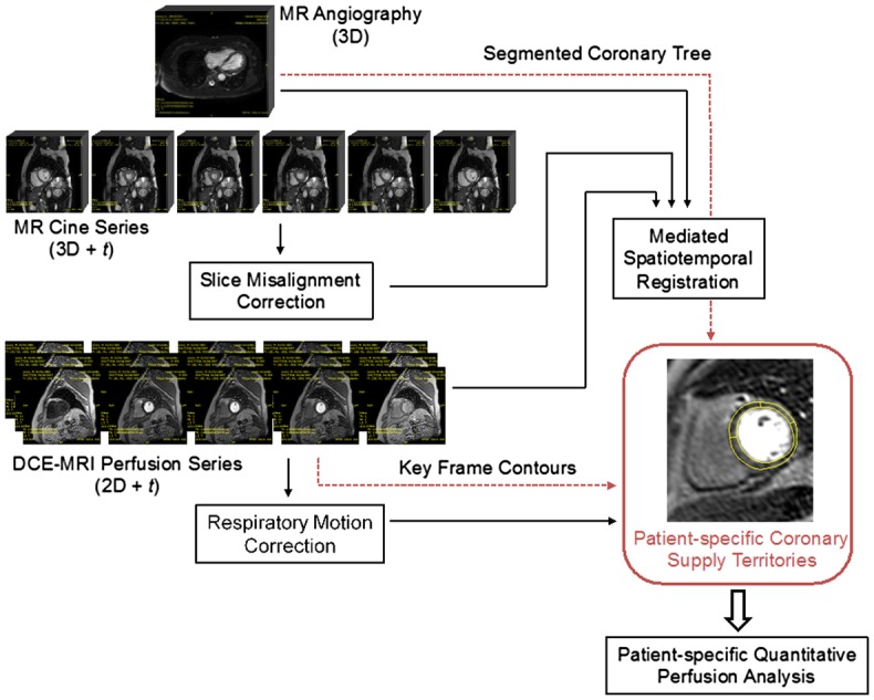 Patient-specific coronary blood supply territories for quantitative perfusion analysis.