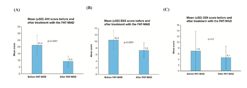 Pilot Study of a New Adjustable Thermoplastic Mandibular Advancement Device for the Management of Obstructive Sleep Apnoea-Hypopnoea Syndrome: A Brief Research Letter.