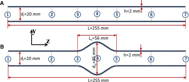 FSI Simulations of Pulse Wave Propagation in Human Abdominal Aortic Aneurysm: The Effects of Sac Geometry and Stiffness.