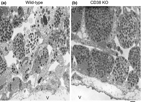 Somato-axodendritic release of oxytocin into the brain due to calcium amplification is essential for social memory.