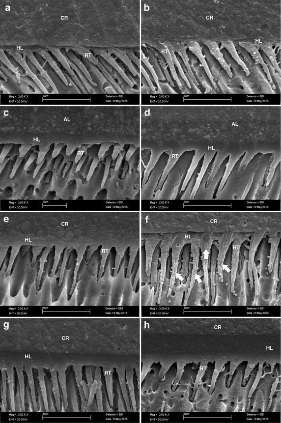 Bond strength and micromorphology of resin-dentin interface of etch-and-rinse dentin bonding agents after 1-year of water storage