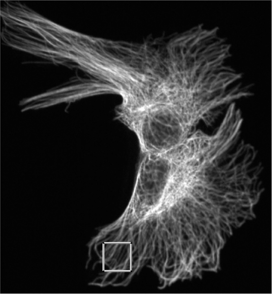 Determination of Statistical Properties of Microtubule Populations.