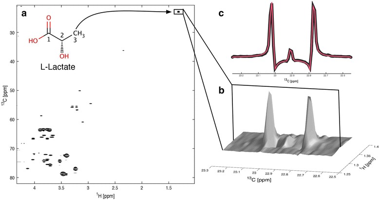 (13)C glucose labelling studies using 2D NMR are a useful tool for determining ex vivo whole organ metabolism during hypothermic machine perfusion of kidneys.
